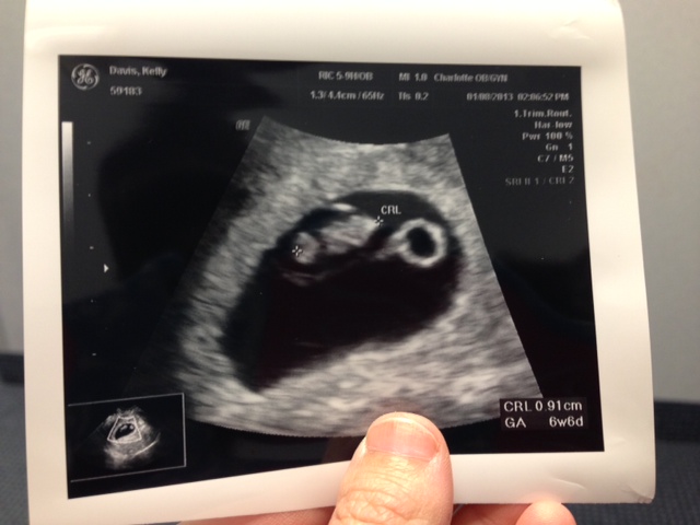 6w6d